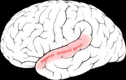 Middle temporal gyrus